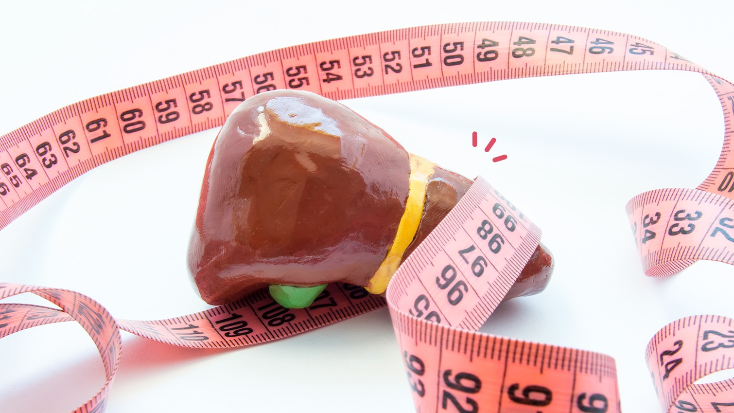 Qual a dieta ideal para Doença hepática gordurosa não-alcoólica ?