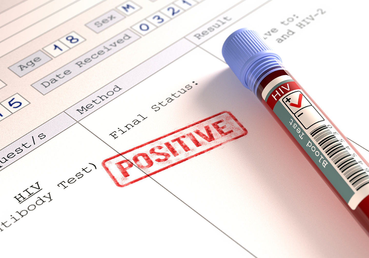 Decifrando os Resultados da Carga Viral do HIV: o que significa blip, não detectável, indetectável